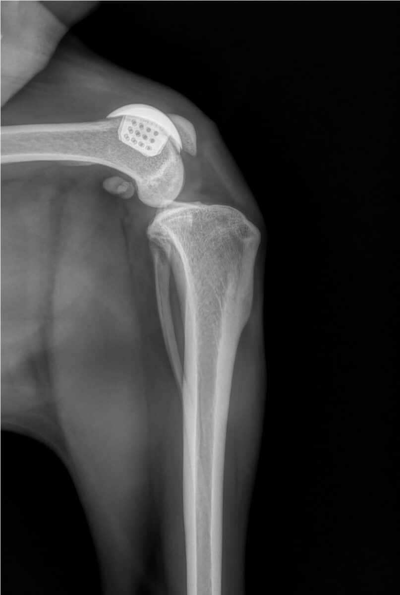 radiografia dopo protesi trp