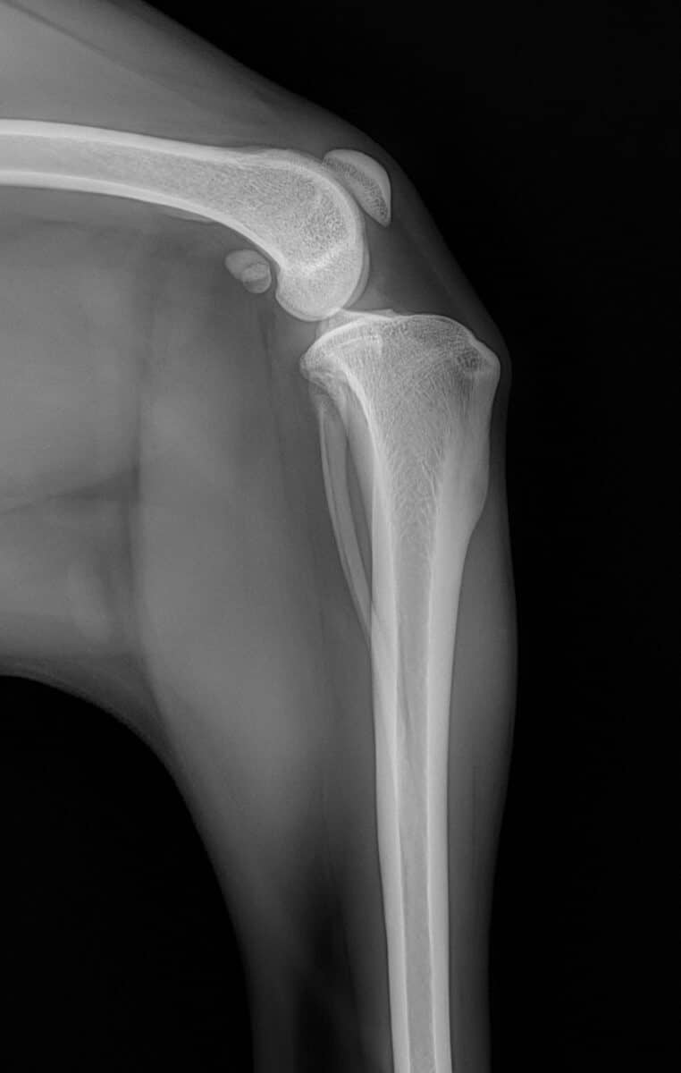 radiografia prima protesi trp